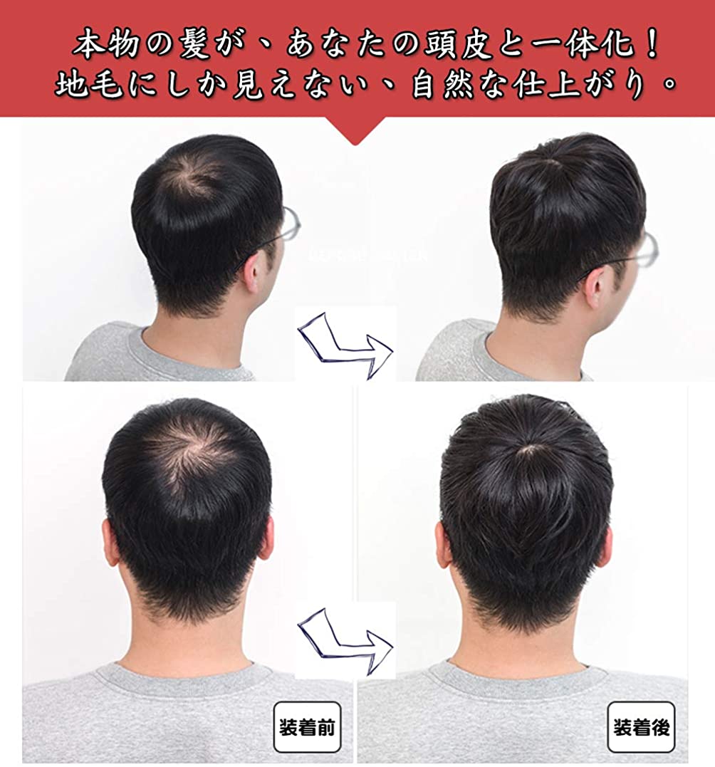 FESHFEN ウィッグ メンズ ヘアピース 部分ウィッグ かつら ポイントウィッグ 人毛100％ 白髪隠れ 増毛 ショート 医療用 トップカバー 自然な黒 KF19-2S - ウインドウを閉じる